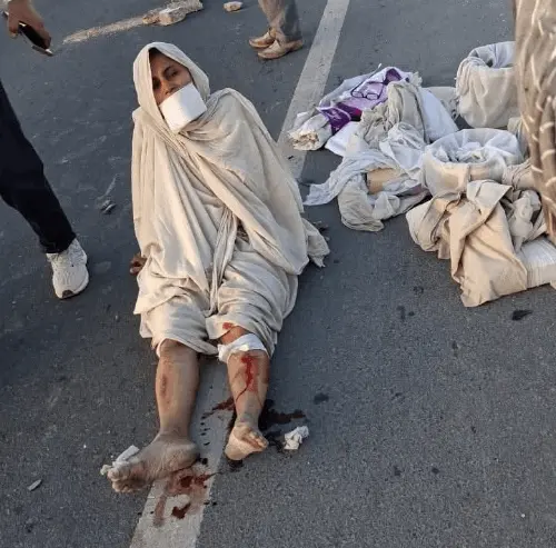 ImgResizer_20251220_0643_31550